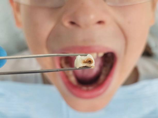 Best Tooth Pain Emergency Relief  in Towanda, KS
